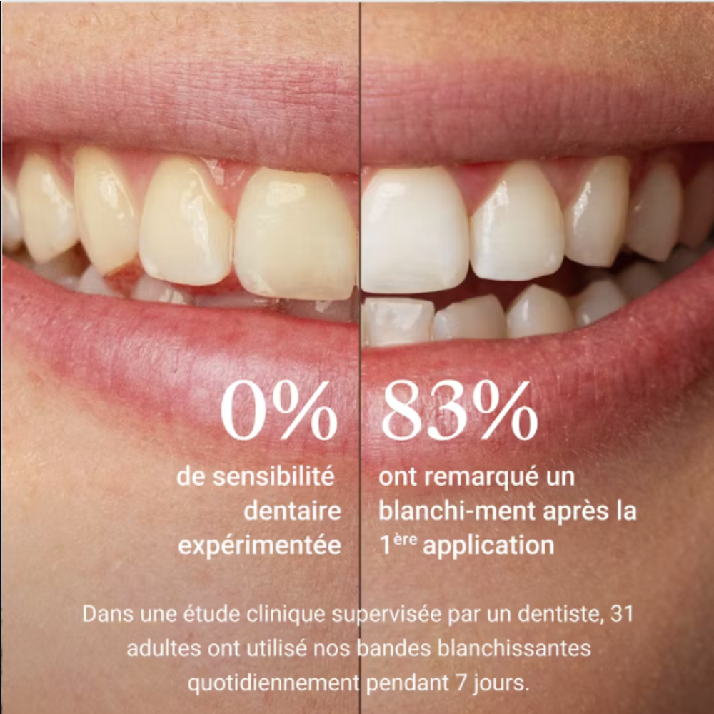 UNIKASMILE  BANDES BLANCHISSANTES SANS PEROXYDE, éclat instantané - des dents blanches en un instant