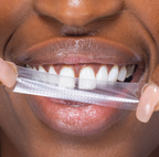 UNIKASMILE  BANDES BLANCHISSANTES SANS PEROXYDE, éclat instantané - des dents blanches en un instant
